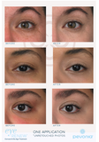 EyeRenew Conceal & De-Age